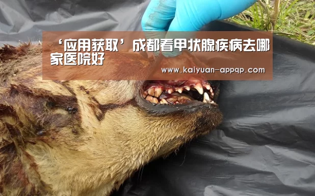 ‘应用获取’成都看甲状腺疾病去哪家医院好(图2) 应用获取